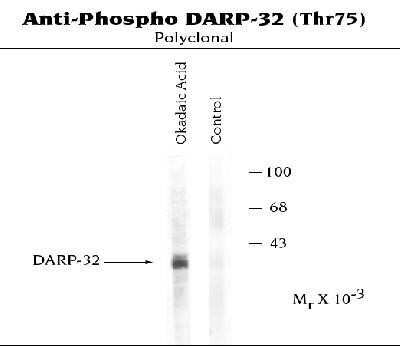 Western Blot: DARPP-32 [p Thr75] Antibody [NB300-234]